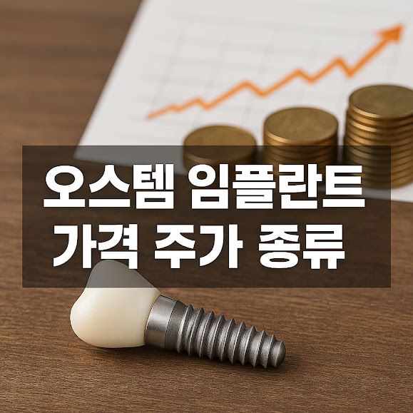 오스템 임플란트 가격, 주가, 종류 총정리: 한 번에 확인하기